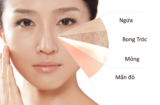 Khi triệt lông cho da nhạy cảm cần lưu ý những gì?