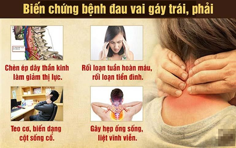 Massage cổ vai gáy thư giãn, giảm đau nhức hiệu quả