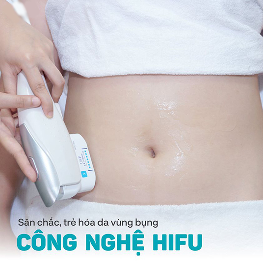 Hifu bụng dưới