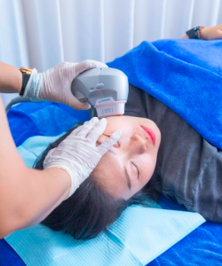HIFU MẮT